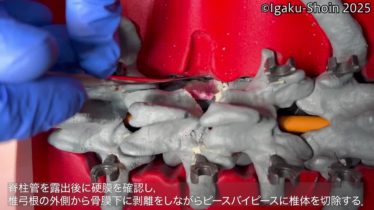 動画5　ＰＳＯの基本手技①