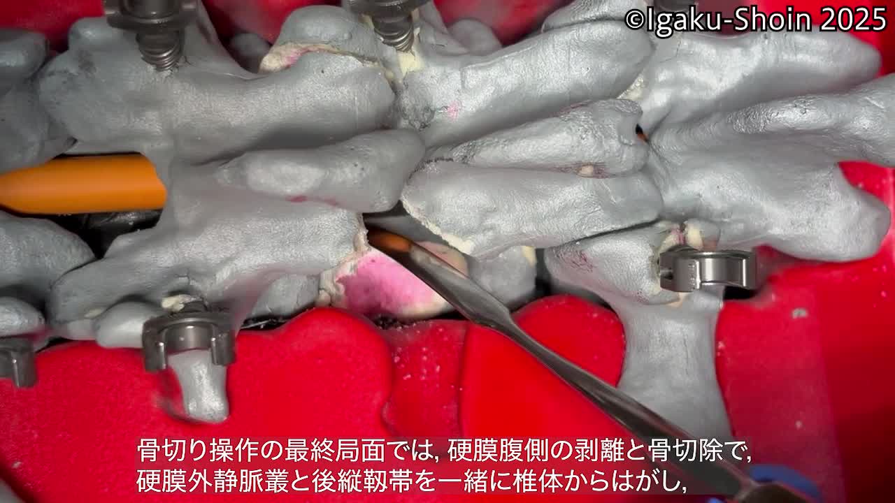 動画7　ＰＳＯの基本手技③