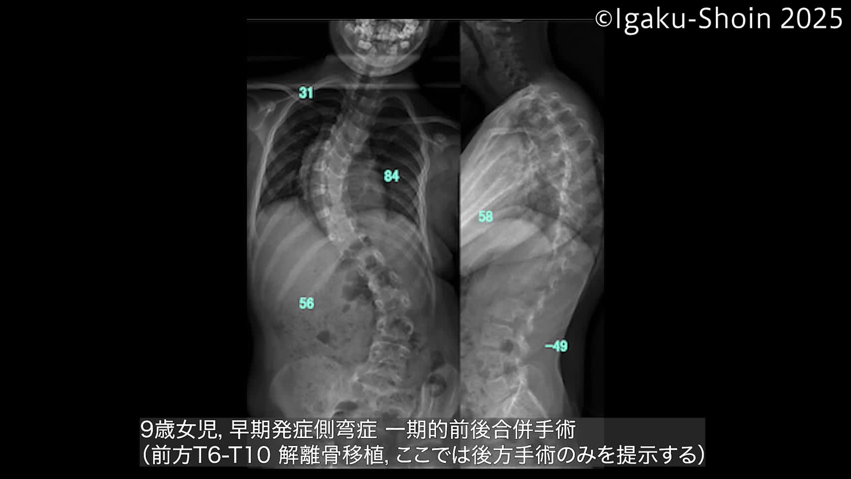動画13　Shilla手術