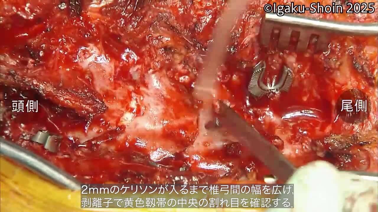 動画14　Songer cable の設置方法
