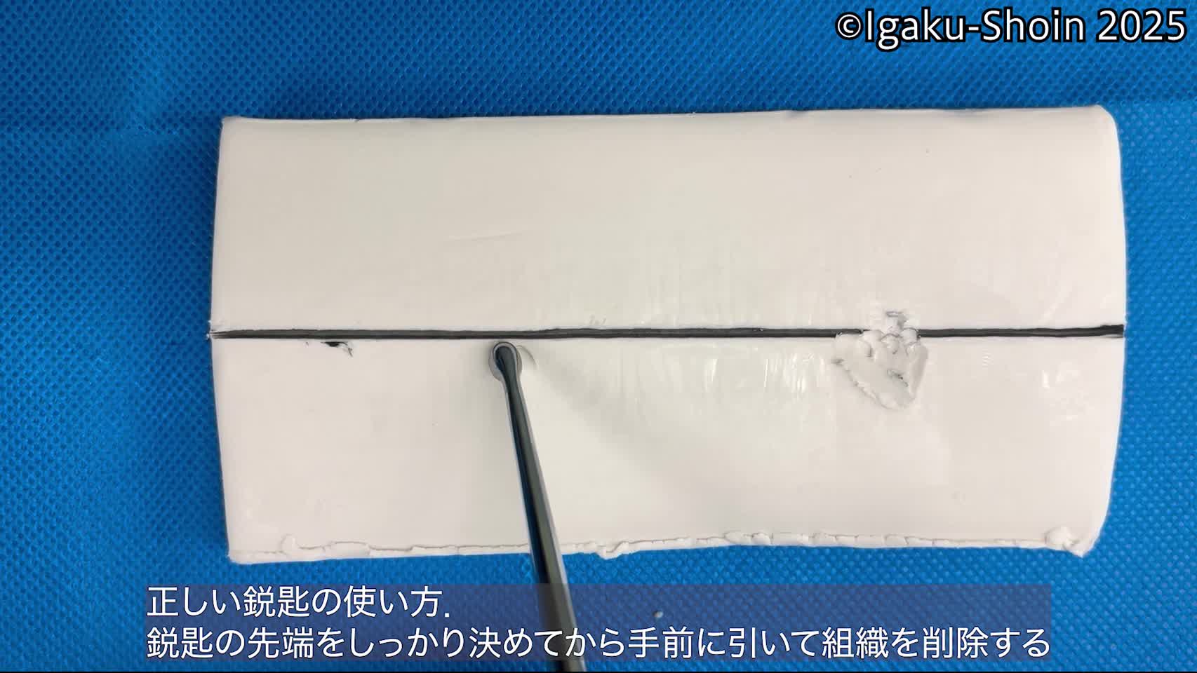 動画32　正しい鋭匙の使い方