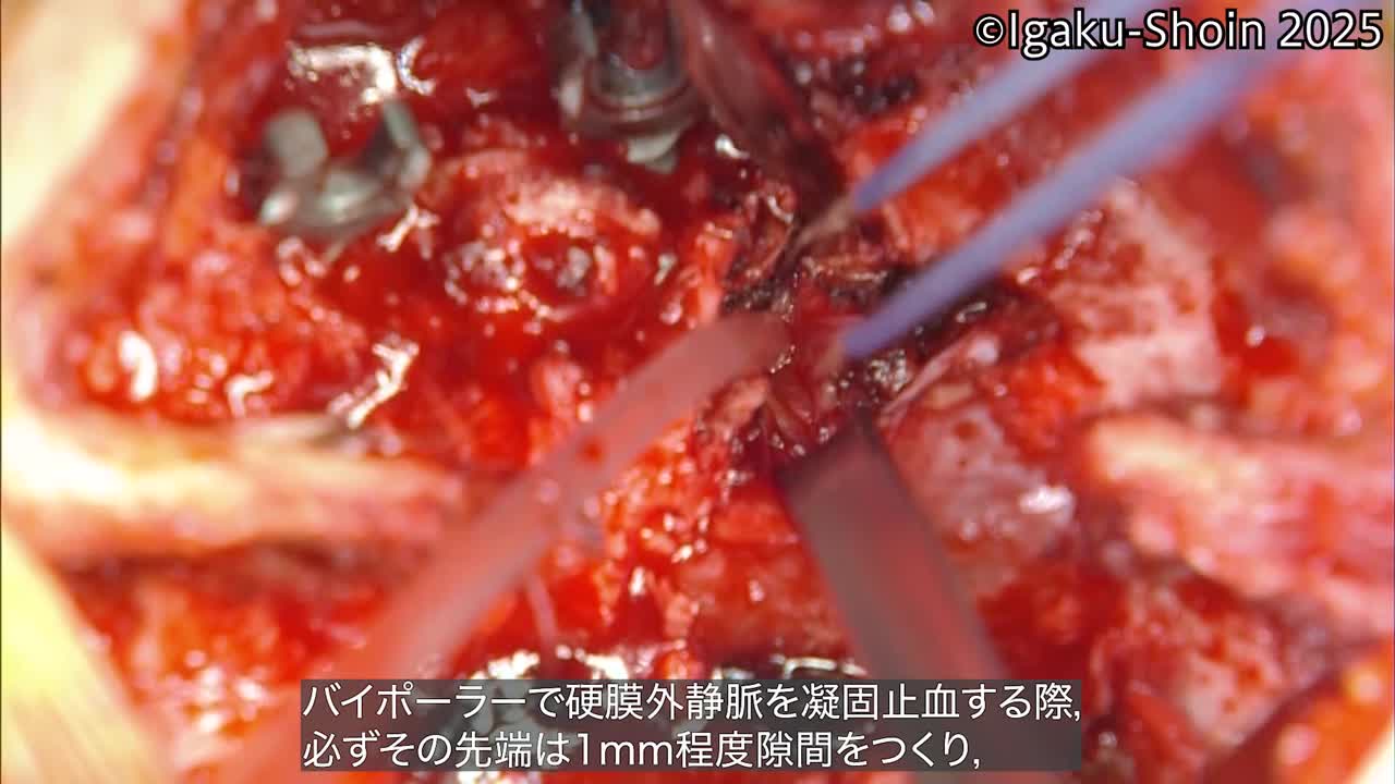 動画36　ノミの使い方：削る